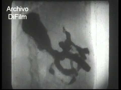 DiFilm - Los rayos X - Un film cultural de la UFA 1937