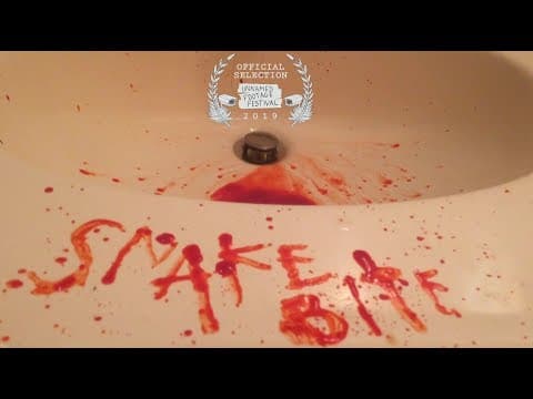 SNAKE BITE